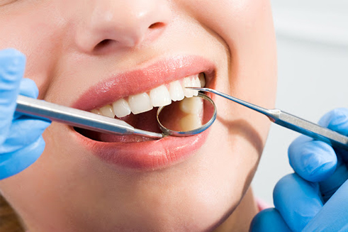 Root Canal Treatment