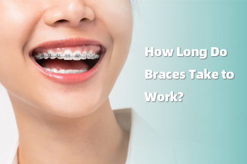 How Long Do Braces Take to Work?