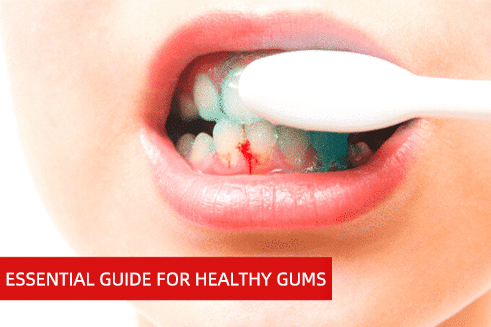 Healthy Gums